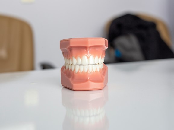 Mold of a full set of teeth to represent permanent crowns after dental implant healing time