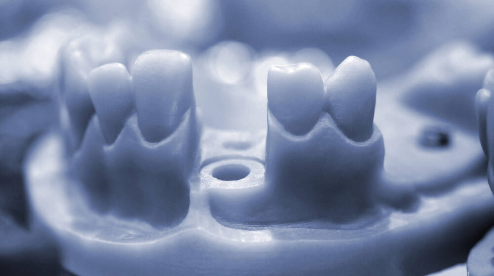 The Future of 3D Printing in Dental Implant Technology