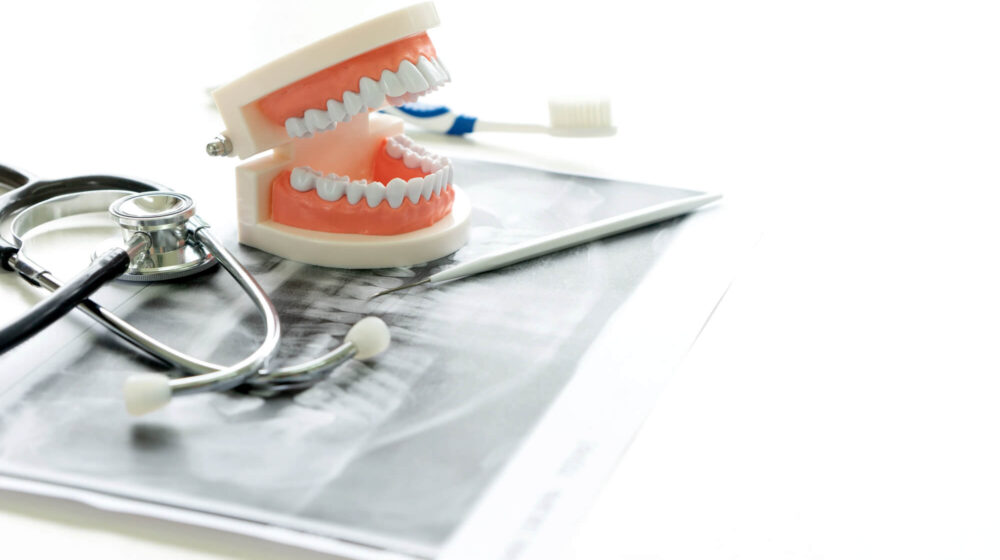 Understanding Common Dental Implant Complications