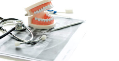 Understanding Common Dental Implant Complications