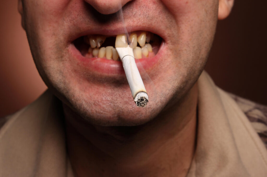 Dental Implant Challenges and Solutions for Smokers