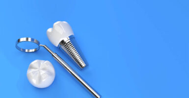 Removing a Failed Dental Implant