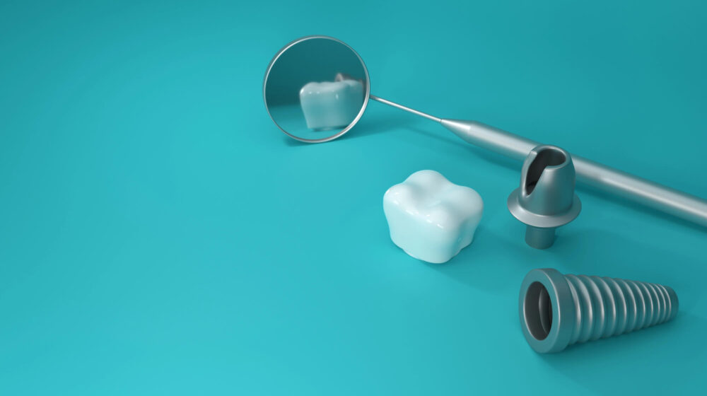 Traditional vs. Immediate Load Implants Which Is Better