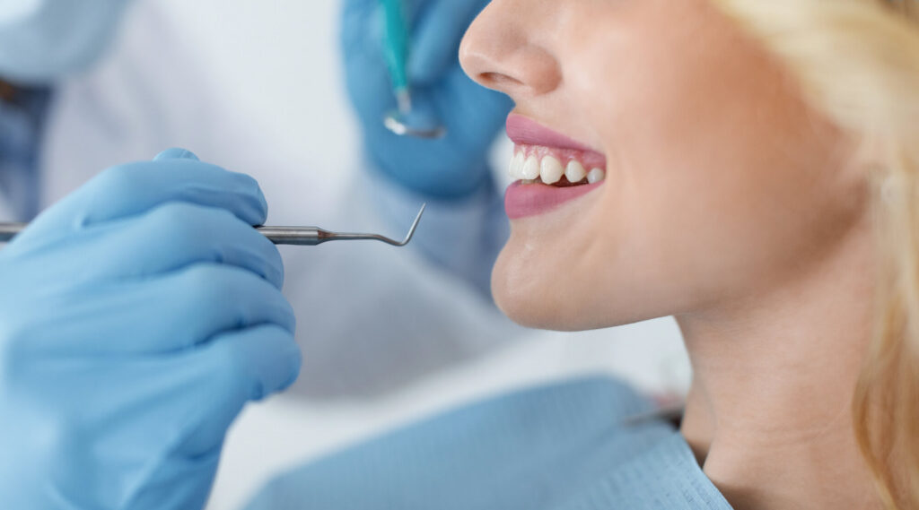 Explicación de los procedimientos más comunes de odontología estética