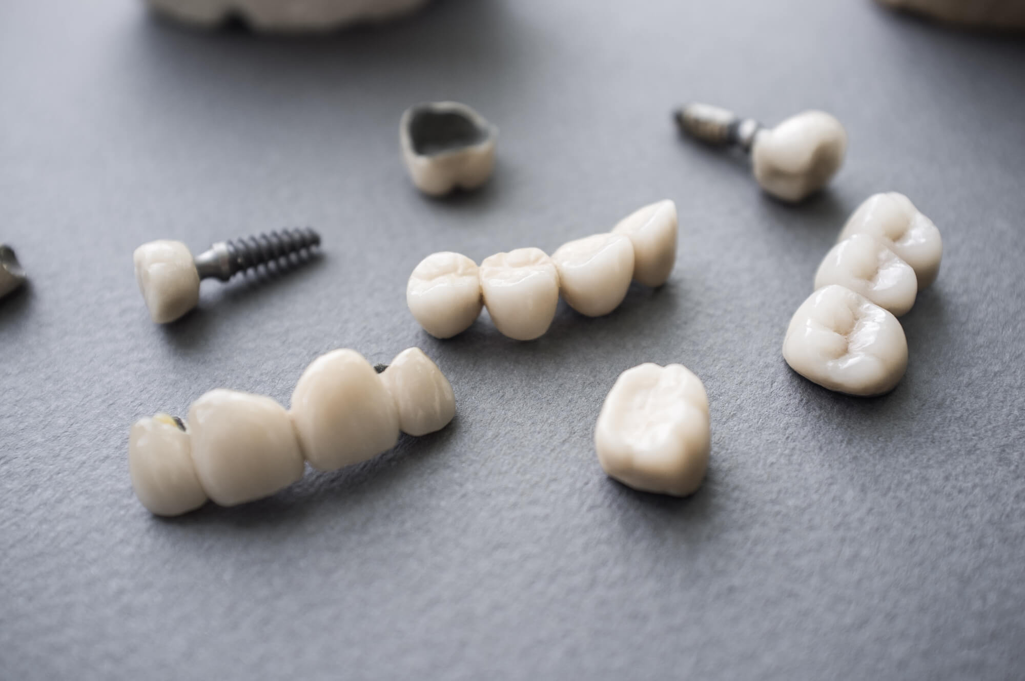 Does Insurance Cover Cosmetic Dentistry