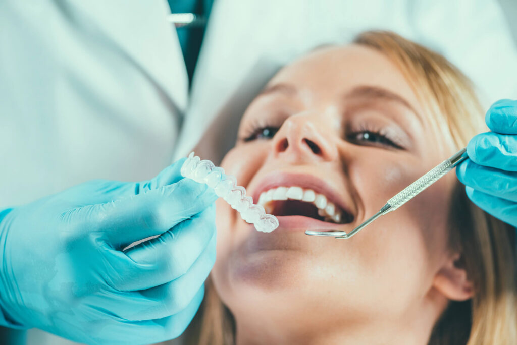 Opciones de blanqueamiento dental profesional