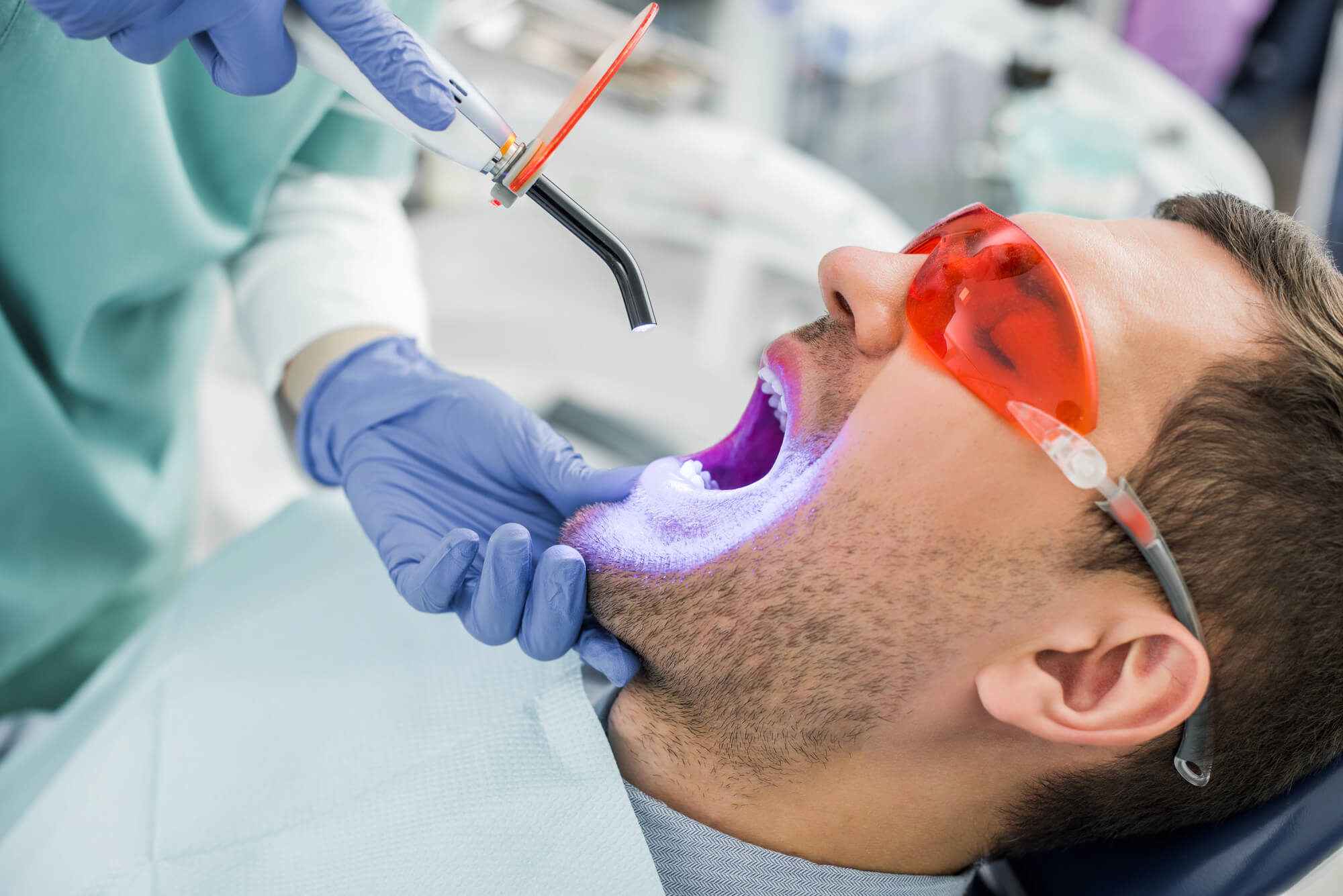 Professional Teeth Whitening Options