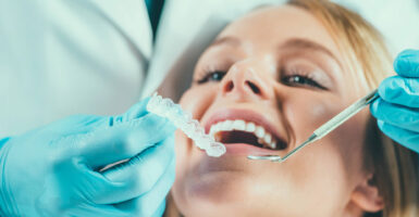 Professional Teeth Whitening Options