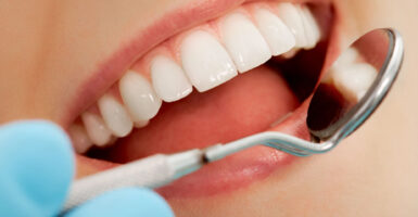 Gum Contouring & Gum Lifts