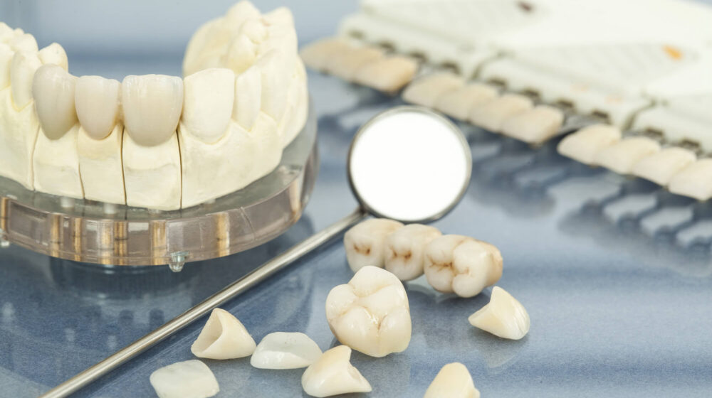 A Complete Guide to Porcelain Veneers