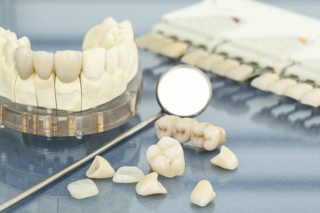 A Complete Guide to Porcelain Veneers