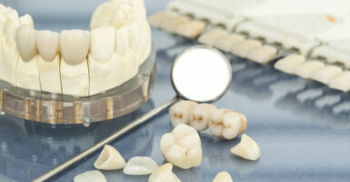 A Complete Guide to Porcelain Veneers