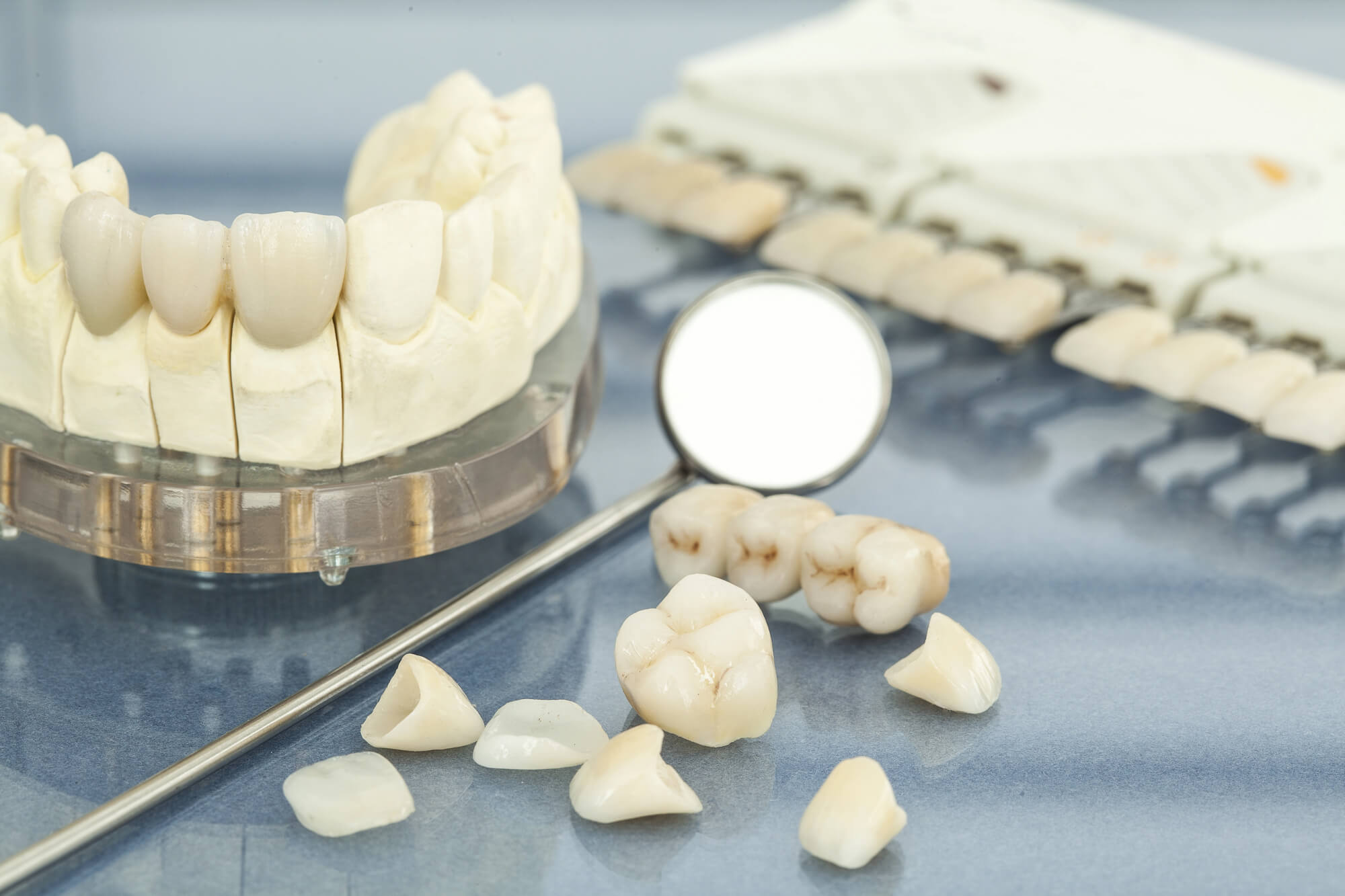 A Complete Guide to Porcelain Veneers