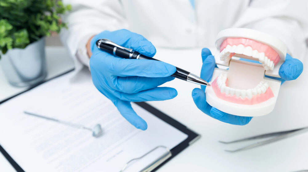 Composite Veneers