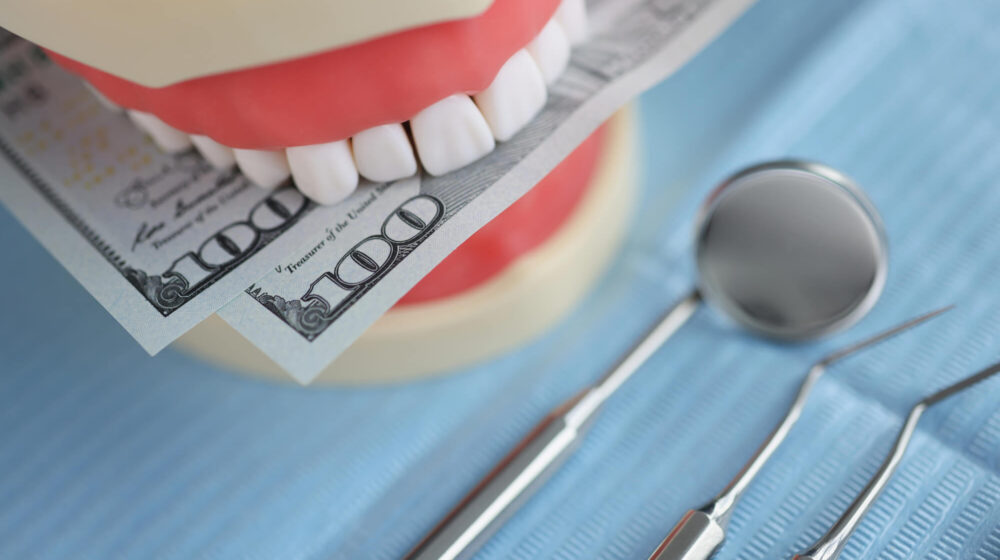 How Much Do Veneers Cost