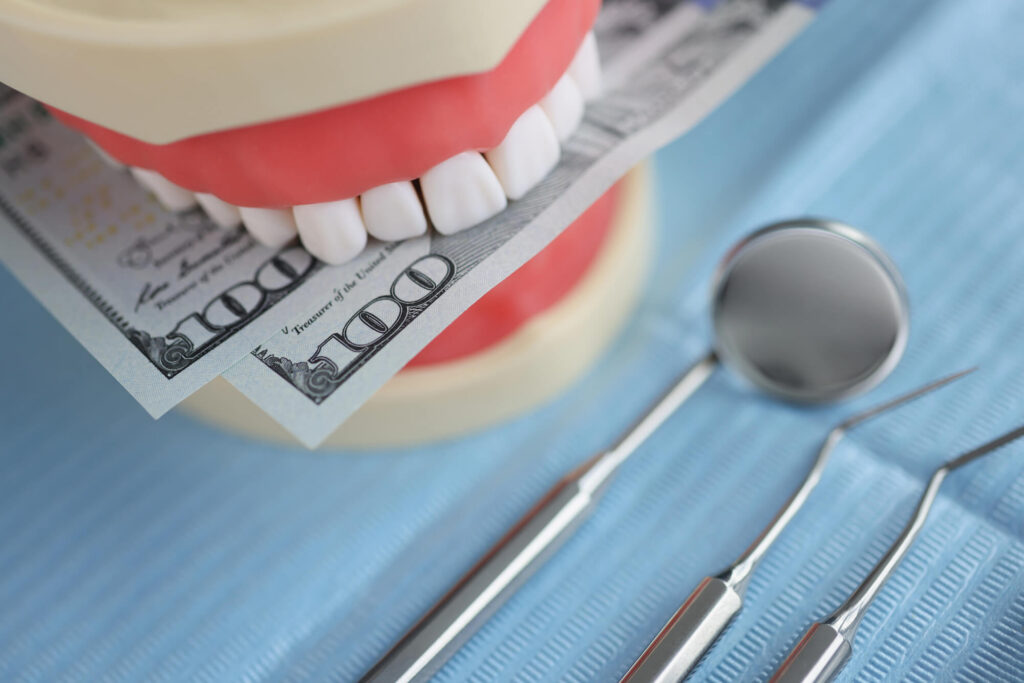 How Much Do Veneers Cost