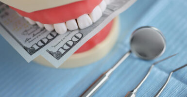 How Much Do Veneers Cost