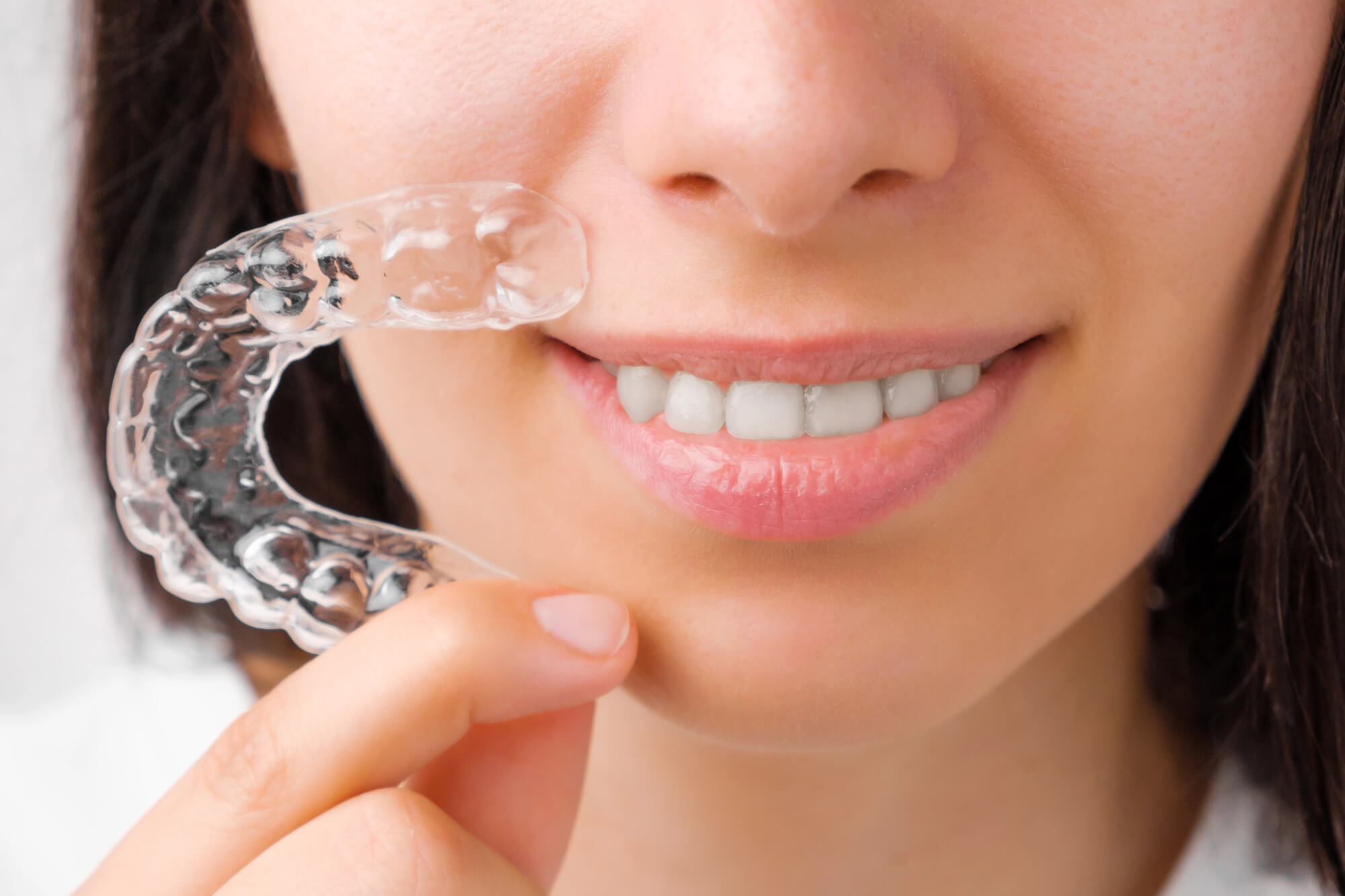 How to Fix Crooked Teeth Without Braces