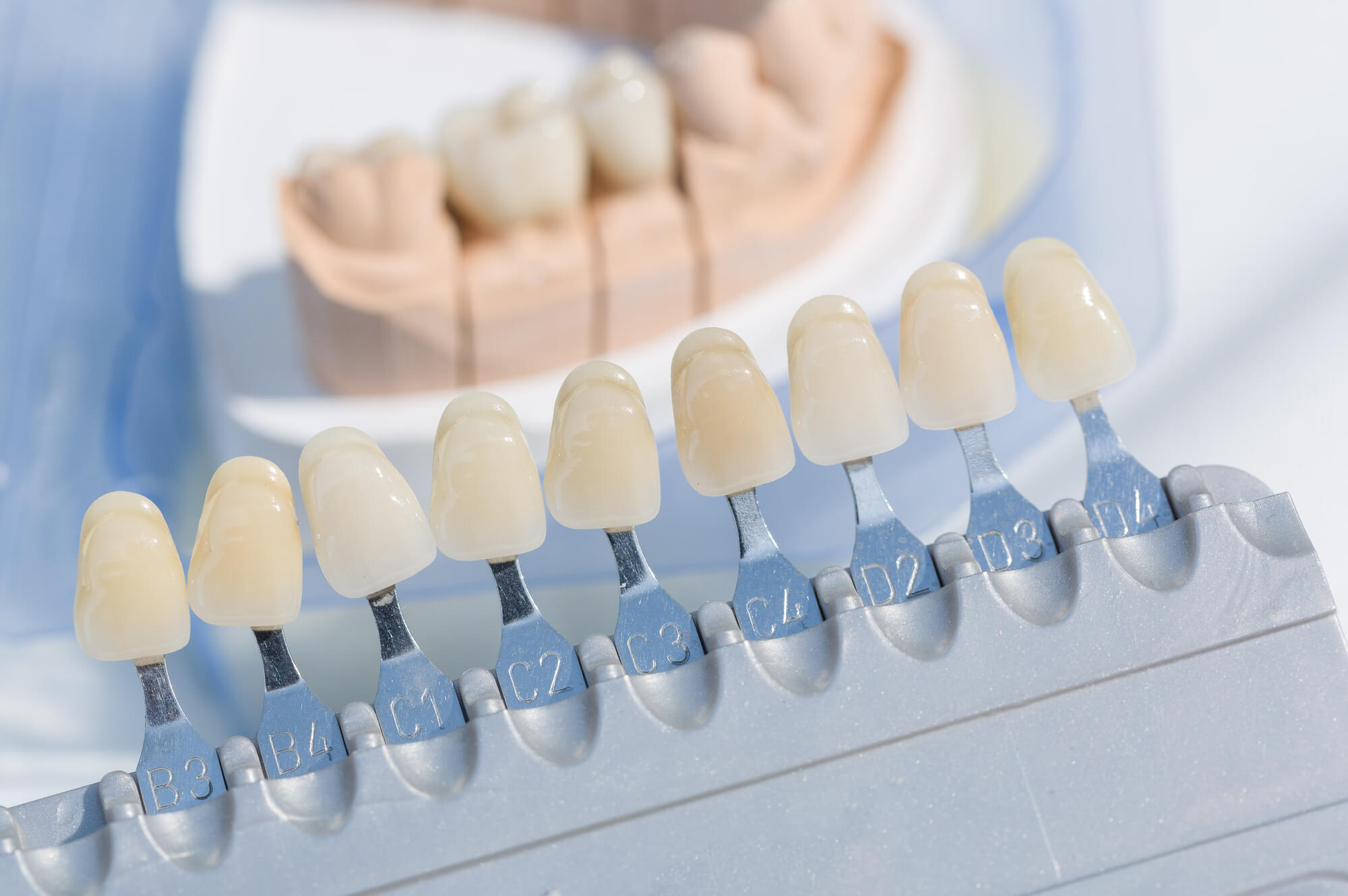 Worn Down Teeth