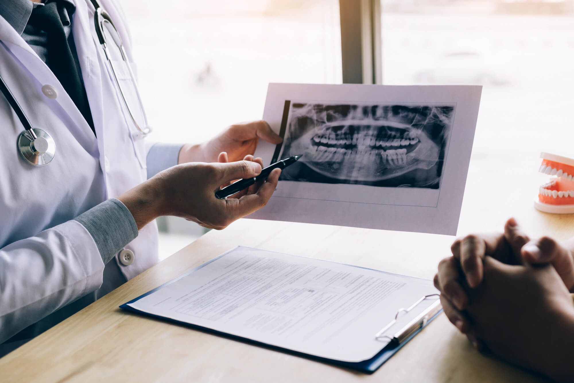 All-on-4 Dental Implants Explained